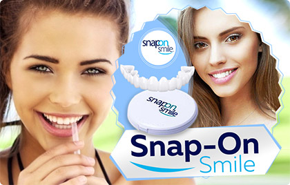 Snap-On-Smile