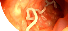 /assets_page/db1061719088ca3c2dcd8661f92cbf9595be4f52/intestines.png
