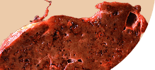 /assets_page/db1061719088ca3c2dcd8661f92cbf9595be4f52/liver.png